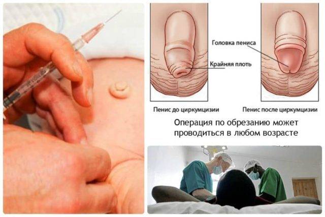 chem_i_kak_mozhno_snizit_chuvstvitelnost_golovki_v_domashnih_usloviyah__4