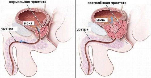 pochemu_byvayut_sgustki_v_sperme_u_muzhchin_2