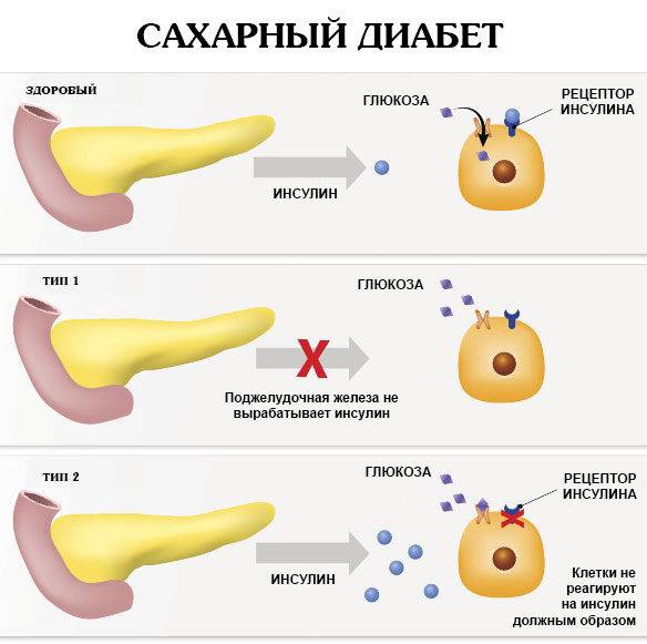 sutochnyy-diurez-norma-4