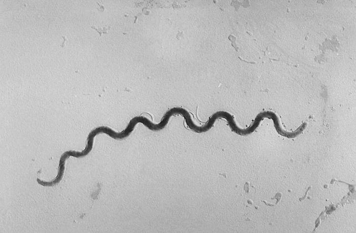treponema-pallidum